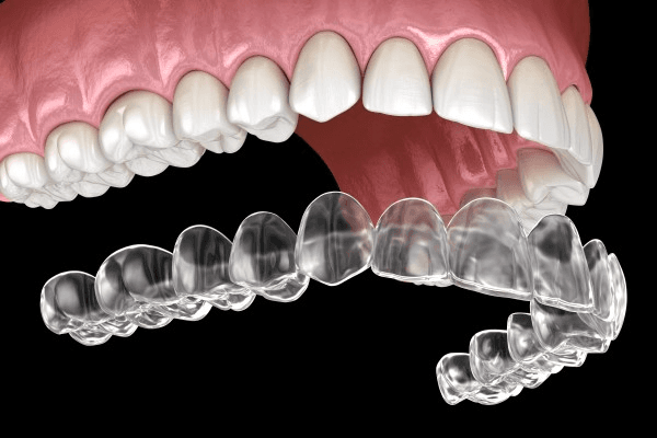 Invisalign at Central Washington Dental Care in Ellensburg WA