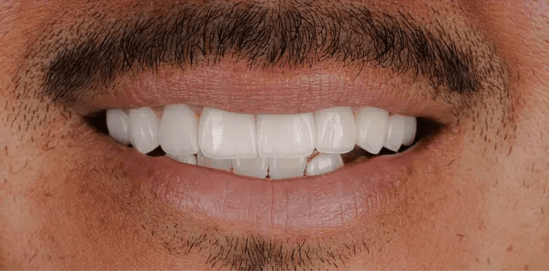 After dental treatment at Central Washington Dental Care