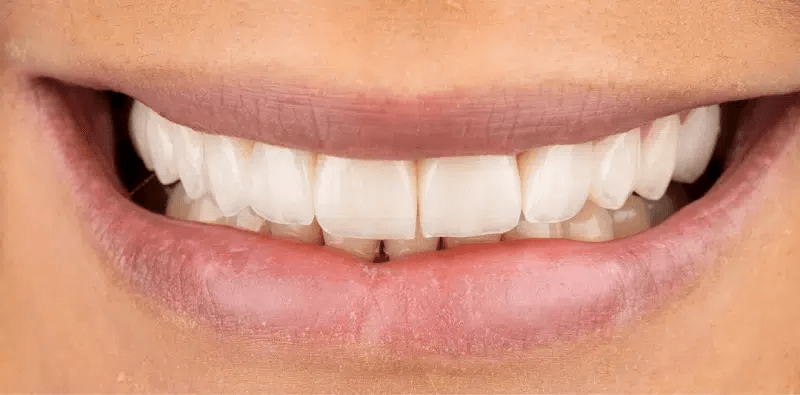 After dental treatment at Central Washington Dental Care