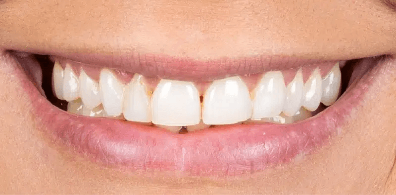 Before dental treatment at Central Washington Dental Care