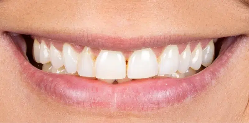 Before Dental Treatment - Tri City Dental Care